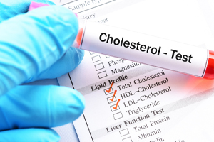 Understanding Cholesterol